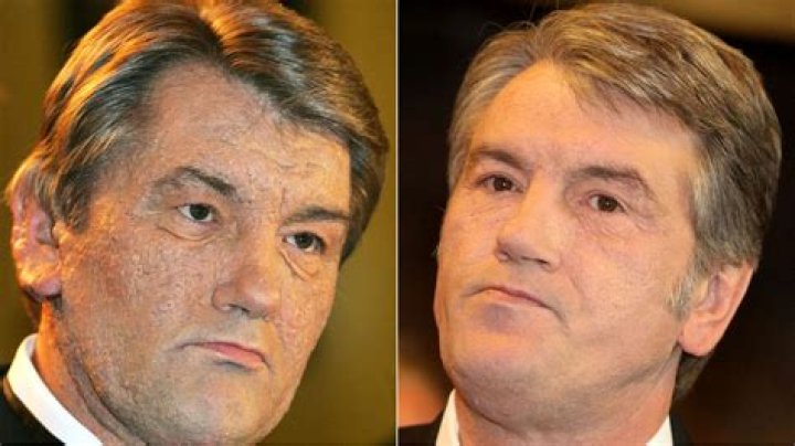 How was Viktor Yushchenko poisoned?
