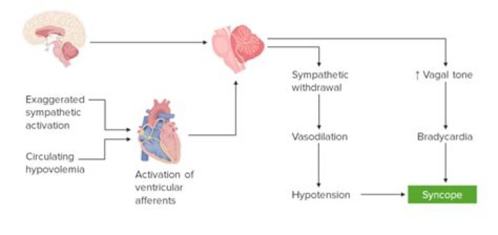 Is neurocardiogenic syncope and autonomic dysfunction?