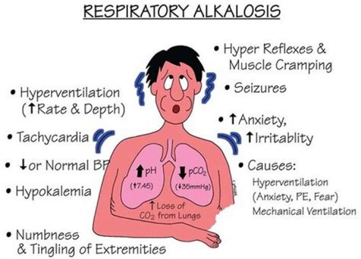 Is respiratory alkalosis respiratory failure?