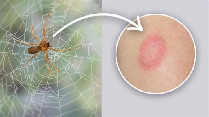 What do British spider bites look like?