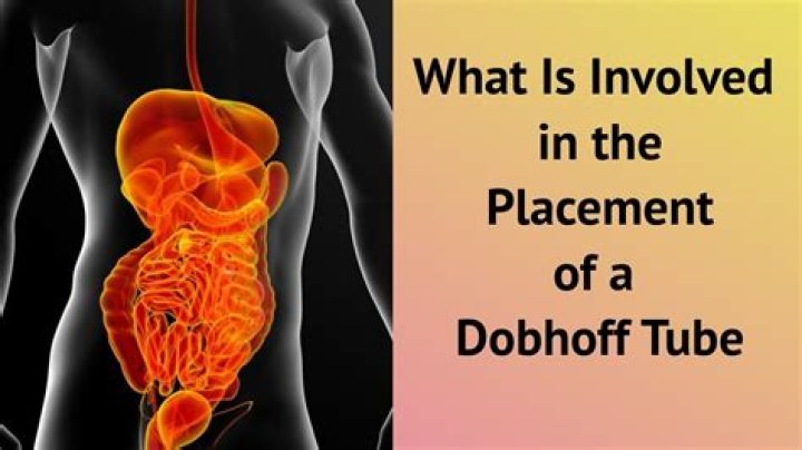 Where should tip of Dobhoff be?